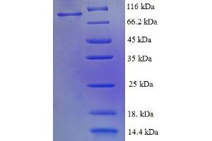 SDS-PAGE (SDS) image for Replication Protein A1, 70kDa (RPA1) (AA 2-616) protein (His-SUMO Tag) (ABIN5710272)