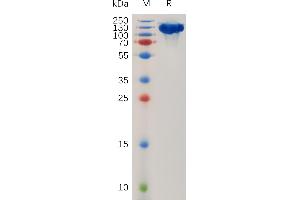 Human R Protein, hFc Tag on SDS-PAGE under reducing condition.