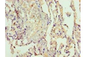 Immunohistochemistry of paraffin-embedded human lung tissue using ABIN7167072 at dilution of 1:100 (MAPKSP1 anticorps  (AA 1-124))