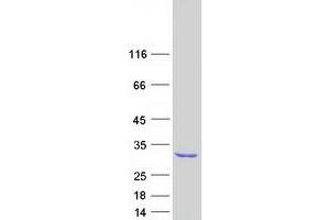 Validation with Western Blot
