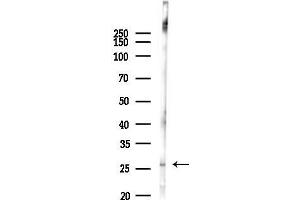 Western blot analysis of lysates from Mouse liver, using GSTM5 Antibody at 1/1000 dilution.