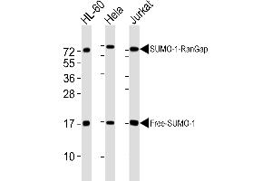 All lanes : Anti-SUMO1 Antibody at 1:4000 dilution Lane 1: HL-60 whole cell lysates Lane 2: Hela whole cell lysates Lane 3: Jurkat whole cell lysates Lysates/proteins at 20 μg per lane. (SUMO1 anticorps)