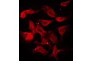 anti-Growth Hormone Releasing Hormone Receptor (GHRHR) (C-Term) antibody