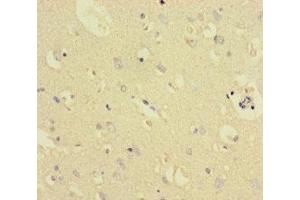 Immunohistochemistry of paraffin-embedded human brain tissue using ABIN7172006 at dilution of 1:100 (TXNDC8 anticorps  (AA 1-115))