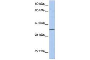 Image no. 1 for anti-Proline Rich 18 (PRR18) (AA 35-84) antibody (ABIN6743875) (Proline Rich 18 anticorps  (AA 35-84))