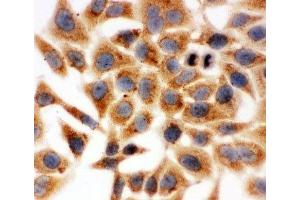 ICC testing of HeLa cells