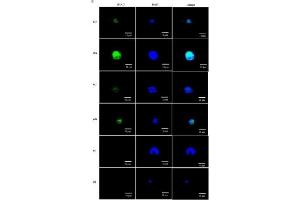 Cyclic AMP (cAMP) response element-binding protein (CREB) acts as a transcription factor to stimulate the expression of MUC2 upon exogenous NAD+ administration.