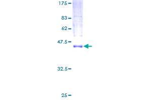 Image no. 1 for Multiple Coagulation Factor Deficiency 2 (MCFD2) (AA 1-146) protein (GST tag) (ABIN1310538) (MCFD2 Protein (AA 1-146) (GST tag))
