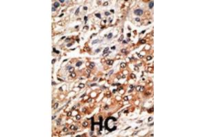 Immunohistochemistry (IHC) image for anti-Bcl2 Modifying Factor (BMF) (BH3 Domain) antibody (ABIN2997142)