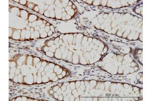 Immunoperoxidase of monoclonal antibody to PSMC4 on formalin-fixed paraffin-embedded human colon.