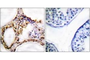 Immunohistochemistry analysis of paraffin-embedded human testis, using RAD52 (Phospho-Tyr104) Antibody.