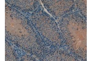 Detection of MYO1A in Mouse Testis Tissue using Polyclonal Antibody to Myosin IA (MYO1A) (Myosin IA anticorps  (AA 783-1043))