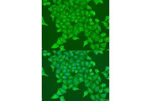 Immunofluorescence analysis of U2OS cells using BST2 antibody (ABIN1871361) at dilution of 1:100. (BST2 anticorps)