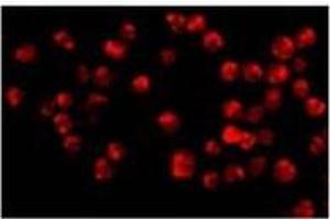 Immunofluorescence of Acinus in K562 cells with with Acinusat 20 µg/ml.