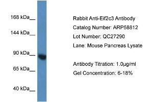 Western Blotting (WB) image for anti-Eukaryotic Translation Initiation Factor 2C3 (EIF2C3) (N-Term) antibody (ABIN2787837) (EIF2C3 anticorps  (N-Term))