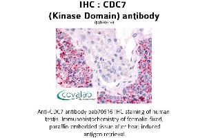 Image no. 1 for anti-Cell Division Cycle 7 (CDC7) antibody (ABIN1732914) (CDC7 anticorps)