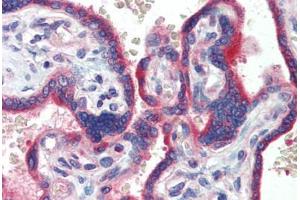 anti-Zinc Finger Protein 165 (ZNF165) (AA 216-265) antibody