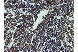 Immunoperoxidase of monoclonal antibody to CREB1 on formalin-fixed paraffin-embedded human lymph node tissue.