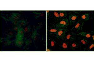 Immunofluorescence (IF) image for anti-Tripartite Motif Containing 28 (TRIM28) (pSer824) antibody (ABIN7454038) (Recombinant KAP1 anticorps  (pSer824))