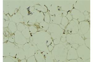 ABIN6272509 at 1/100 staining Human lung tissue by IHC-P.