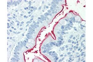 Anti-NPC1L1 antibody IHC staining of human small intestine. (NPC1L1 anticorps  (Internal Region))