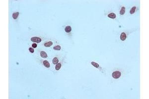 Immunocytochemistry analysis of ABIN7127312 diluted at 1:100 and staining in Hela cells performed on a Leica BondTM system.