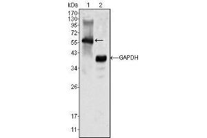 Western Blot showing MATK antibody used against K562 cell lysate (1).