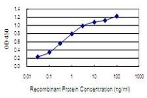 Detection limit for recombinant GST tagged NARG1 is 0.