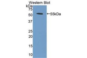 Western Blotting (WB) image for anti-Bone Morphogenetic Protein 5 (BMP5) (AA 317-454) antibody (ABIN3205479) (BMP5 anticorps  (AA 317-454))