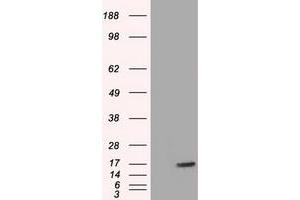 HEK293T cells were transfected with the pCMV6-ENTRY control (Left lane) or pCMV6-ENTRY TTC32 (Right lane) cDNA for 48 hrs and lysed. (TTC32 anticorps)