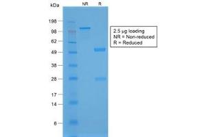 SDS-PAGE analysis of purified, BSA-free recombinant NKX2.