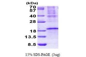 SDS-PAGE (SDS) image for OCIA Domain Containing 2 (OCIAD2) (AA 1-154) protein (His tag) (ABIN5852964)