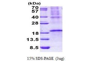 SDS-PAGE (SDS) image for OCIA Domain Containing 2 (OCIAD2) (AA 1-154) protein (His tag) (ABIN5852964) (OCIAD2 Protein (AA 1-154) (His tag))