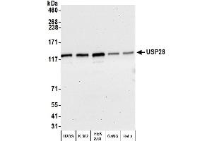 Western Blotting (WB) image for anti-Ubiquitin Specific Peptidase 28 (USP28) (AA 50-100) antibody (ABIN7454683) (USP28 anticorps  (AA 50-100))