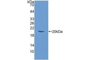 Detection of Recombinant EIF2aK3, Mouse using Polyclonal Antibody to Eukaryotic Translation Initiation Factor 2 Alpha Kinase 3 (EIF2aK3) (PERK anticorps  (AA 973-1114))