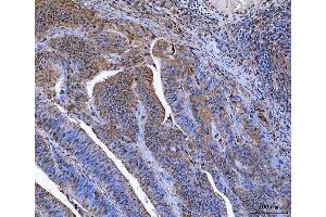 IHC analysis of Glutathione Reductase using anti-Glutathione Reductase antibody (ABIN5693151). (Glutathione Reductase anticorps  (AA 256-522))