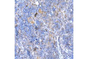 Immunohistochemistry of paraffin-embedded mouse spleen using M Rabbit pAb (ABIN3021414, ABIN3021415, ABIN3021416 and ABIN6215021) at dilution of 1:500 (40x lens). (MAGED1 anticorps  (AA 635-834))
