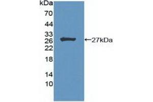 Figure. (Menin anticorps  (AA 219-395))
