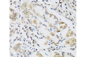 Immunohistochemistry of paraffin-embedded Human stomach using RETN Polyclonal Antibody at dilution of 1:100 (40x lens). (Resistin anticorps)