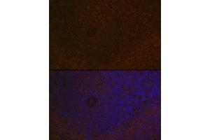 Immunofluorescence analysis of rat spleen using C Rabbit mAb (ABIN7266125) at dilution of 1:100 (40x lens).