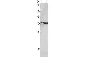 Gel: 8 % SDS-PAGE, Lysate: 40 μg, Lane 1-2: Hela cells, 293T cells, Primary antibody: ABIN7191430(MCMBP Antibody) at dilution 1/1300, Secondary antibody: Goat anti rabbit IgG at 1/8000 dilution, Exposure time: 2 minutes (MCMBP anticorps)