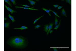 Immunofluorescence of monoclonal antibody to MMP26 on HeLa cell. (MMP26 anticorps  (AA 152-261))