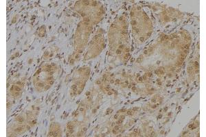 ABIN6276814 at 1/100 staining Human kidney tissue by IHC-P.