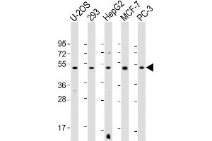 All lanes : Anti-EEF1A1P5 Antibody (C-Term) at 1:1000-1:2000 dilution Lane 1: U-2OS whole cell lysate Lane 2: 293 whole cell lysate Lane 3: HepG2 whole cell lysate Lane 4: MCF-7 whole cell lysate Lane 5: PC-3 whole cell lysate Lysates/proteins at 20 μg per lane. (EEF1A1P5 anticorps  (AA 430-462))