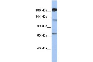 WB Suggested Anti-MTR  Antibody Titration: 0. (MTR anticorps  (C-Term))