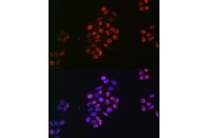 Immunofluorescence analysis of HeLa cells using SOX9 antibody (ABIN7270577).