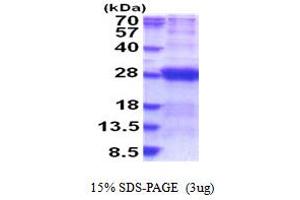 SDS-PAGE (SDS) image for Dynactin 6 (DCTN6) (AA 1-190) protein (His tag) (ABIN5853904)