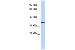 WB Suggested Anti-ZNF660 Antibody Titration:  0. (ZNF660 anticorps  (N-Term))
