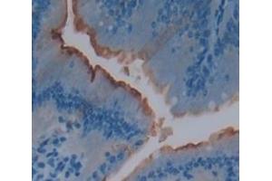 Used in DAB staining on fromalin fixed paraffin- embedded Kidney tissue (IL22R anticorps  (AA 258-552))