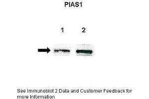 Lanes:   Lane 1: Untreated human U251 lysate Lane 2: IL-1beta treated human U251 lysate  Primary Antibody Dilution:   1:500  Secondary Antibody:   Anti-rabbit-HRP  Secondary Antibody Dilution:   1:500  Gene Name:   PIAS1  Submitted by:   Anonymous (PIAS1 anticorps  (Middle Region))